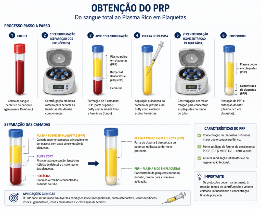 Obtenção do PRP e suas características para que o PRP seja permitido no esporte 

